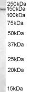 Western blot - Anti-PCB antibody (AB115579)