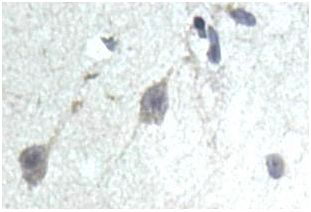 Immunohistochemistry (Formalin/PFA-fixed paraffin-embedded sections) - Anti-PCB antibody (AB196277)