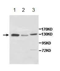 Western blot - Anti-PCB antibody (AB196277)