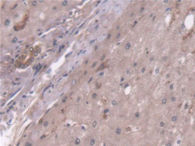 Immunohistochemistry (Formalin/PFA-fixed paraffin-embedded sections) - Anti-PCB antibody (AB233106)
