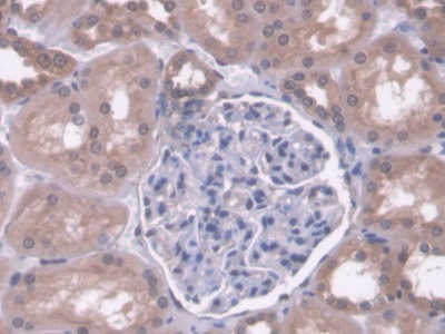 Immunohistochemistry (Formalin/PFA-fixed paraffin-embedded sections) - Anti-PCB antibody (AB233106)