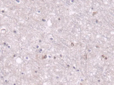 Immunohistochemistry (Formalin/PFA-fixed paraffin-embedded sections) - Anti-PCB antibody (AB233106)