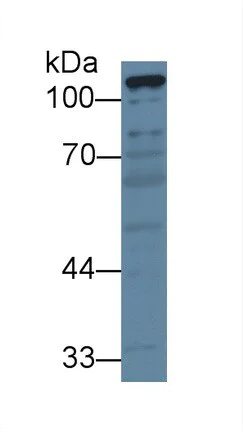 Western blot - Anti-PCB antibody (AB233106)