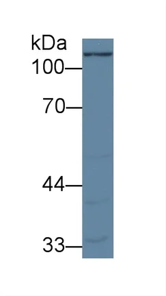 Western blot - Anti-PCB antibody (AB233106)