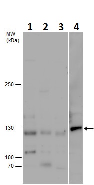 Western blot - Anti-PCB antibody - C-terminal (AB229266)