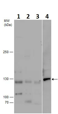 Western blot - Anti-PCB antibody - C-terminal (AB229266)
