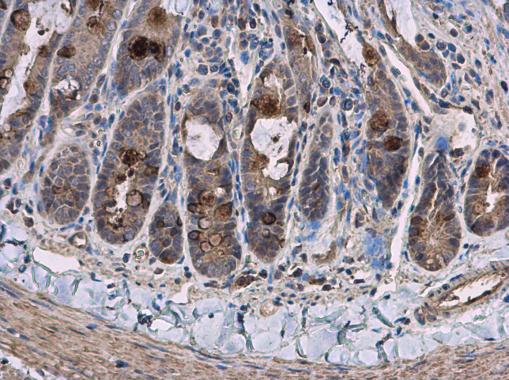 Immunohistochemistry (Formalin/PFA-fixed paraffin-embedded sections) - Anti-PCB antibody - C-terminal (AB229267)
