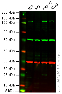 Western blot - Anti-PCB antibody [EPR7366] (AB126707)