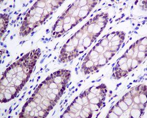 Immunohistochemistry (Formalin/PFA-fixed paraffin-embedded sections) - Anti-PCBD1 antibody [EPR9760(B)] (AB138518)