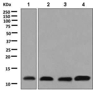 Western blot - Anti-PCBD1 antibody [EPR9760(B)] (AB138518)