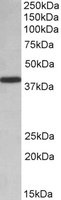 Western blot - Anti-PCBP1 antibody (AB109577)