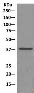 Immunoprecipitation - Anti-PCBP1 antibody [EPR11049(B)] (AB168377), expandable thumbnail