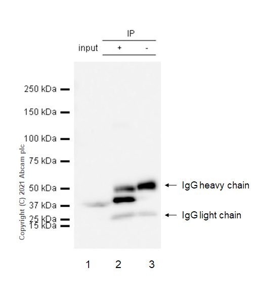 Immunoprecipitation - Anti-PCBP1 antibody [EPR11055] (AB168378), expandable thumbnail
