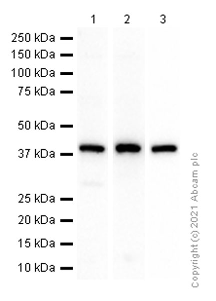 Western blot - Anti-PCBP1 antibody [EPR11055] (AB168378), expandable thumbnail