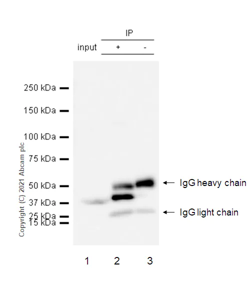 Immunoprecipitation - Anti-PCBP1 antibody [EPR11055] - BSA and Azide free (AB249470)