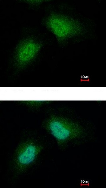 Immunocytochemistry/ Immunofluorescence - Anti-PCBP2/hnRNP E2 antibody (AB154245), expandable thumbnail