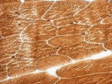 Immunohistochemistry (Formalin/PFA-fixed paraffin-embedded sections) - Anti-PCBP2/hnRNP E2 antibody (AB154245), expandable thumbnail