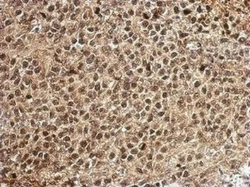 Immunohistochemistry (Formalin/PFA-fixed paraffin-embedded sections) - Anti-PCBP2/hnRNP E2 antibody (AB154245)