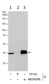 Immunoprecipitation - Anti-PCBP2/hnRNP E2 antibody (AB154245)