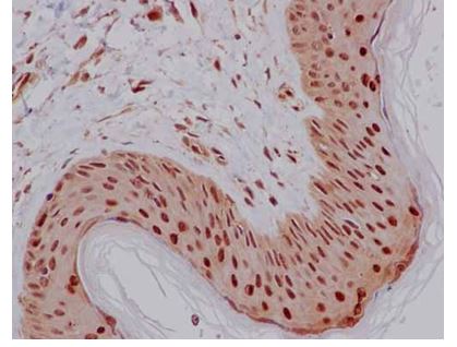 Immunohistochemistry (Formalin/PFA-fixed paraffin-embedded sections) - Anti-PCBP2/hnRNP E2 antibody [EPR14858] (AB184962), expandable thumbnail