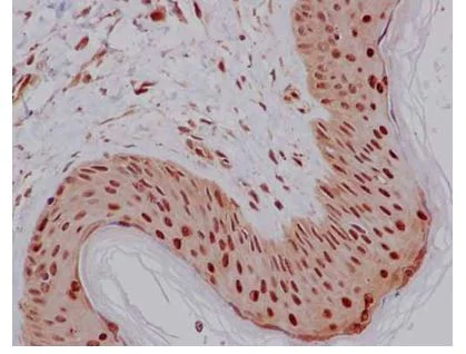 Immunohistochemistry (Formalin/PFA-fixed paraffin-embedded sections) - Anti-PCBP2/hnRNP E2 antibody [EPR14858] (AB184962)