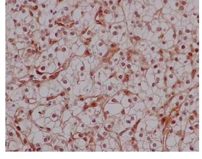 Immunohistochemistry (Formalin/PFA-fixed paraffin-embedded sections) - Anti-PCBP2/hnRNP E2 antibody [EPR14858] (AB184962), expandable thumbnail
