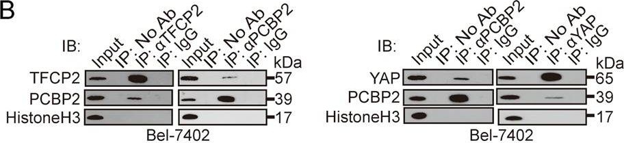 Western blot - Anti-PCBP2/hnRNP E2 antibody [EPR14858] (ab184962), expandable thumbnail