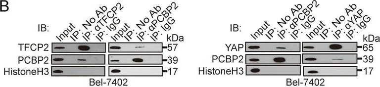 Western blot - Anti-PCBP2/hnRNP E2 antibody [EPR14858] (AB184962)