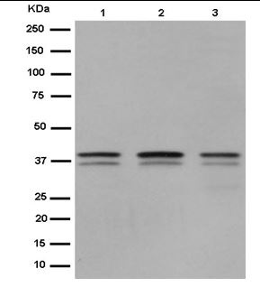 Western blot - Anti-PCBP2/hnRNP E2 antibody [EPR14858] (AB184962), expandable thumbnail
