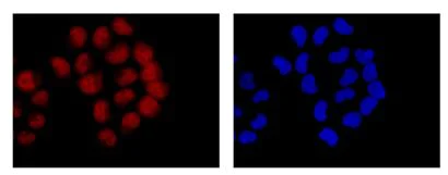 Immunocytochemistry/ Immunofluorescence - Anti-PCBP2/hnRNP E2 antibody [EPR14858] - BSA and Azide free (AB236137)