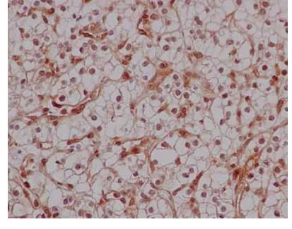 Immunohistochemistry (Formalin/PFA-fixed paraffin-embedded sections) - Anti-PCBP2/hnRNP E2 antibody [EPR14858] - BSA and Azide free (AB236137)