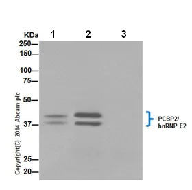 Immunoprecipitation - Anti-PCBP2/hnRNP E2 antibody [EPR14859(2)] - BSA and Azide free (AB251324)