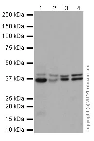 Western blot - Anti-PCBP2/hnRNP E2 antibody [EPR14859(2)] - BSA and Azide free (AB251324)