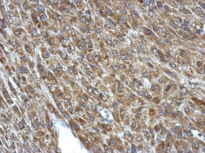 Immunohistochemistry (Formalin/PFA-fixed paraffin-embedded sections) - Anti-PCCA antibody (AB154254), expandable thumbnail