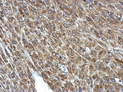 Immunohistochemistry (Formalin/PFA-fixed paraffin-embedded sections) - Anti-PCCA antibody (AB154254)
