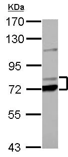 Western blot - Anti-PCCA antibody (AB154254)