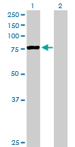 Western blot - Anti-PCCA antibody (AB89784)