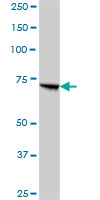 Western blot - Anti-PCCA antibody (AB89784)