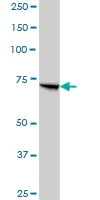 Western blot - Anti-PCCA antibody (AB89784)