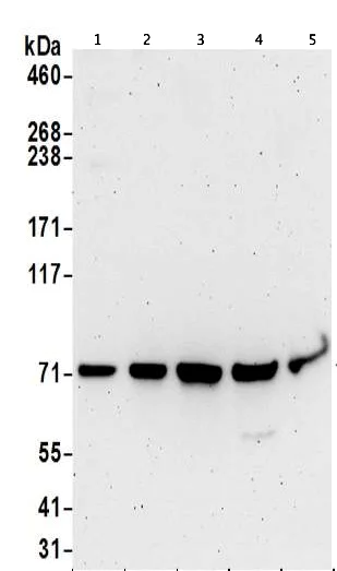 Western blot - Anti-PCCA antibody - C-terminal (AB187686)