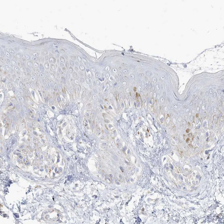 Immunohistochemistry (Formalin/PFA-fixed paraffin-embedded sections) - Anti-PCCB antibody (AB262905)