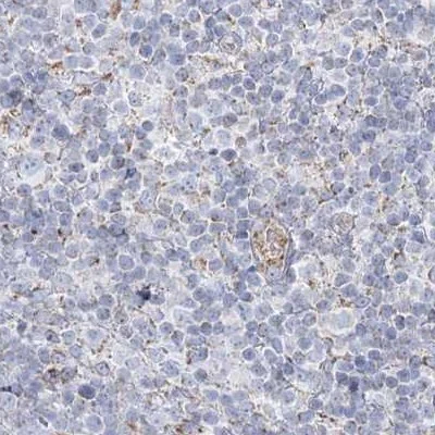 Immunohistochemistry (Formalin/PFA-fixed paraffin-embedded sections) - Anti-PCCB antibody (AB262905)