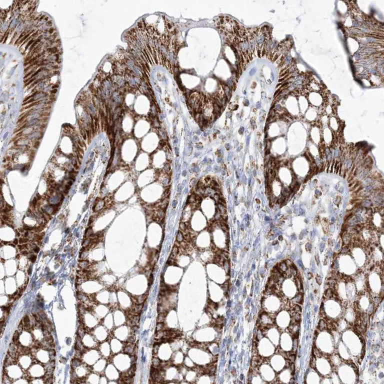 Immunohistochemistry (Formalin/PFA-fixed paraffin-embedded sections) - Anti-PCCB antibody (AB262905)