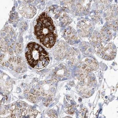 Immunohistochemistry (Formalin/PFA-fixed paraffin-embedded sections) - Anti-PCCB antibody (AB262905)