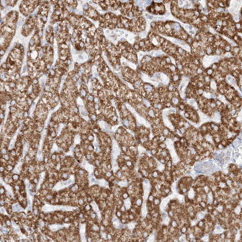 Immunohistochemistry (Formalin/PFA-fixed paraffin-embedded sections) - Anti-PCCB antibody (AB262905)