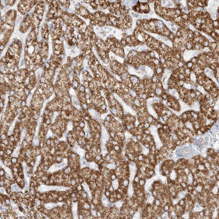 Immunohistochemistry (Formalin/PFA-fixed paraffin-embedded sections) - Anti-PCCB antibody (AB262905)