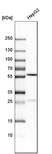 Western blot - Anti-PCCB antibody (AB262905)