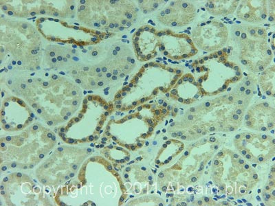 Immunohistochemistry (Formalin/PFA-fixed paraffin-embedded sections) - Anti-PCCB antibody (AB70416)