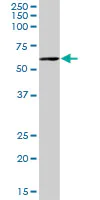 Western blot - Anti-PCCB antibody (AB70416)