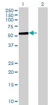 Western blot - Anti-PCCB antibody (AB70416)